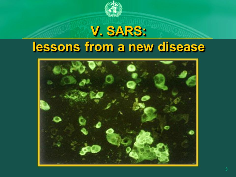 Slide 2 Scope: บทเรียนจากการควบคุม ป้องกันโรคระบาดในระดับ สากล ( กรณี SARS, etc.) WHO กับการประสานความ ร่วมมือระหว่างประเทศใน การเฝ้าระวังและสร้างระบบ เตือนภัยโรคที่อันตราย ร้ายแรง