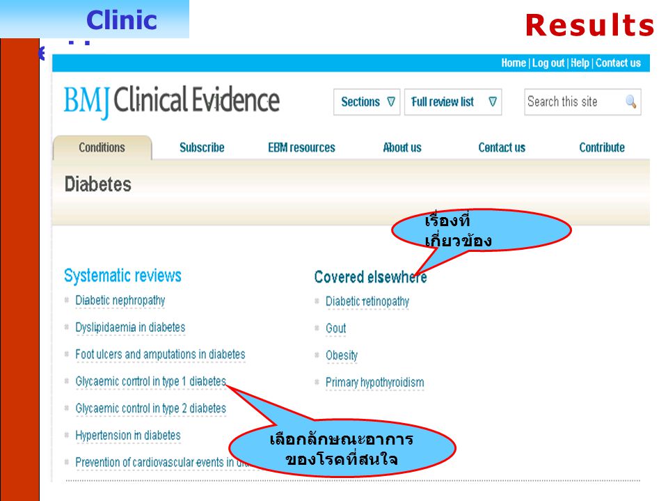 Clinic evidence เลือกลักษณะอาการ ของโรคที่สนใจ Results เรื่องที่ เกี่ยวข้อง