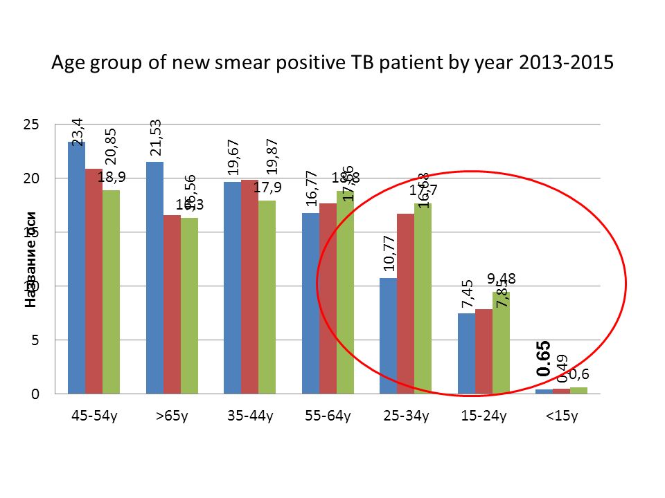 Age group of new smear positive TB patient by year