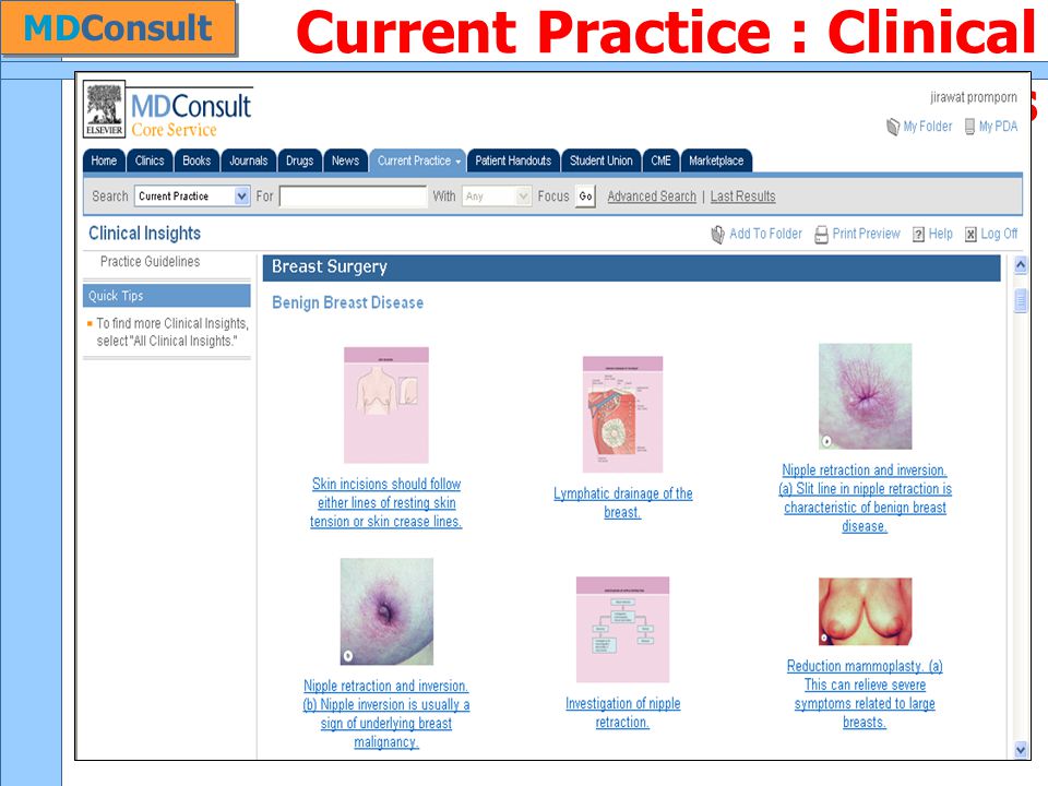 Current Practice : Clinical Insights MDConsult