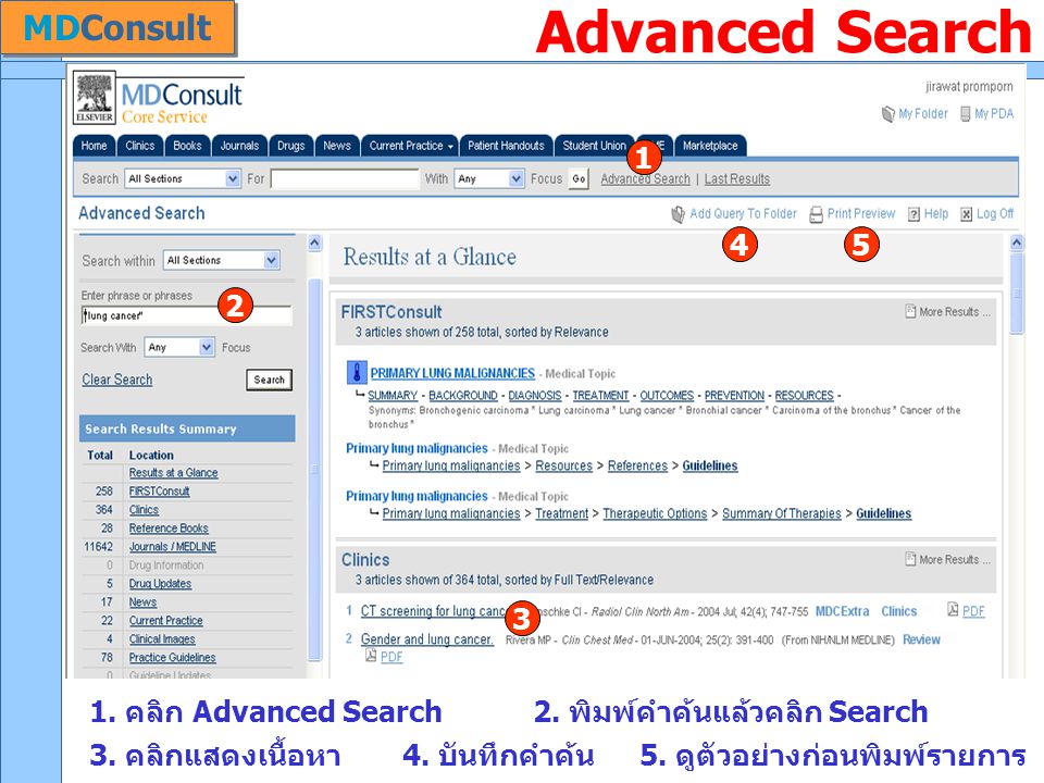 Advanced Search MDConsult 1. คลิก Advanced Search 1 2.