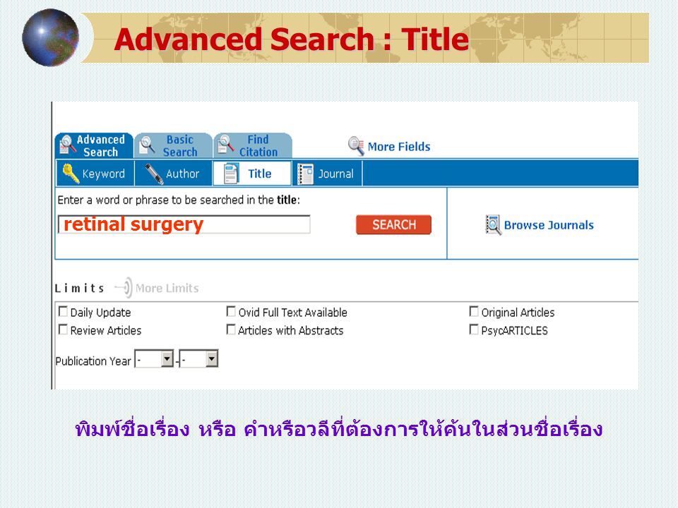 Advanced Search : Title พิมพ์ชื่อเรื่อง หรือ คำหรือวลีที่ต้องการให้ค้นในส่วนชื่อเรื่อง retinal surgery