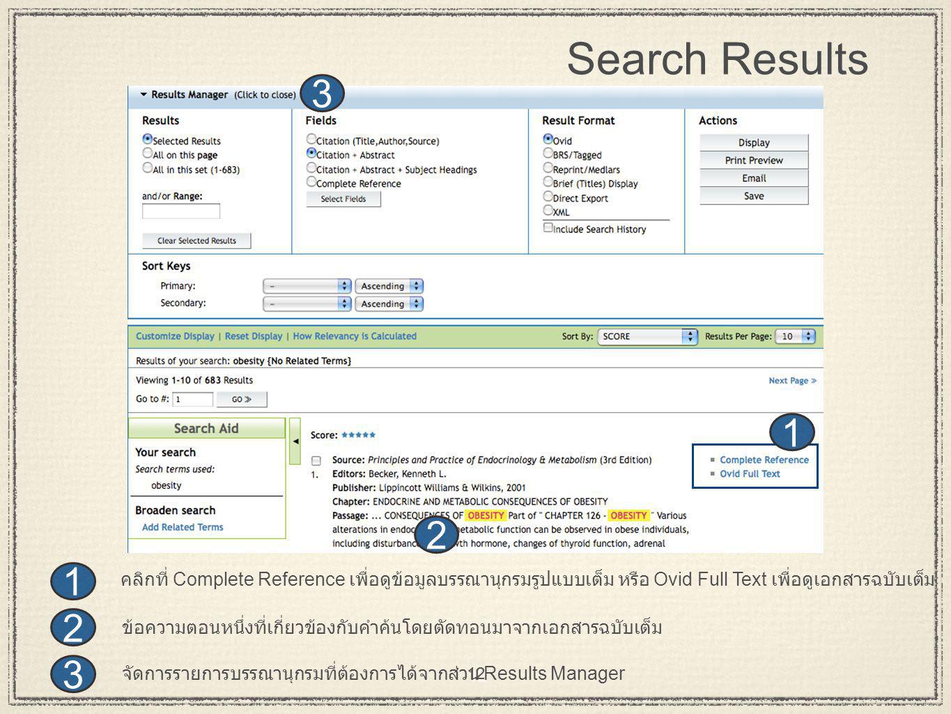 12 Search Results จัดการรายการบรรณานุกรมที่ต้องการได้จากส่วน Results Manager ข้อความตอนหนึ่งที่เกี่ยวข้องกับคำค้นโดยตัดทอนมาจากเอกสารฉบับเต็ม คลิกที่ Complete Reference เพื่อดูข้อมูลบรรณานุกรมรูปแบบเต็ม หรือ Ovid Full Text เพื่อดูเอกสารฉบับเต็ม 1 12