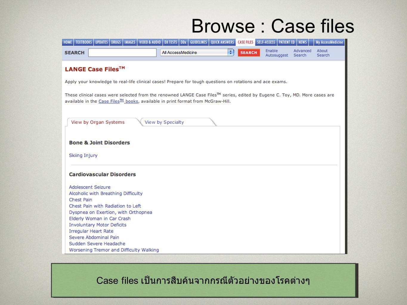 21 Browse : Case files Case files เป็นการสืบค้นจากกรณีตัวอย่างของโรคต่างๆ