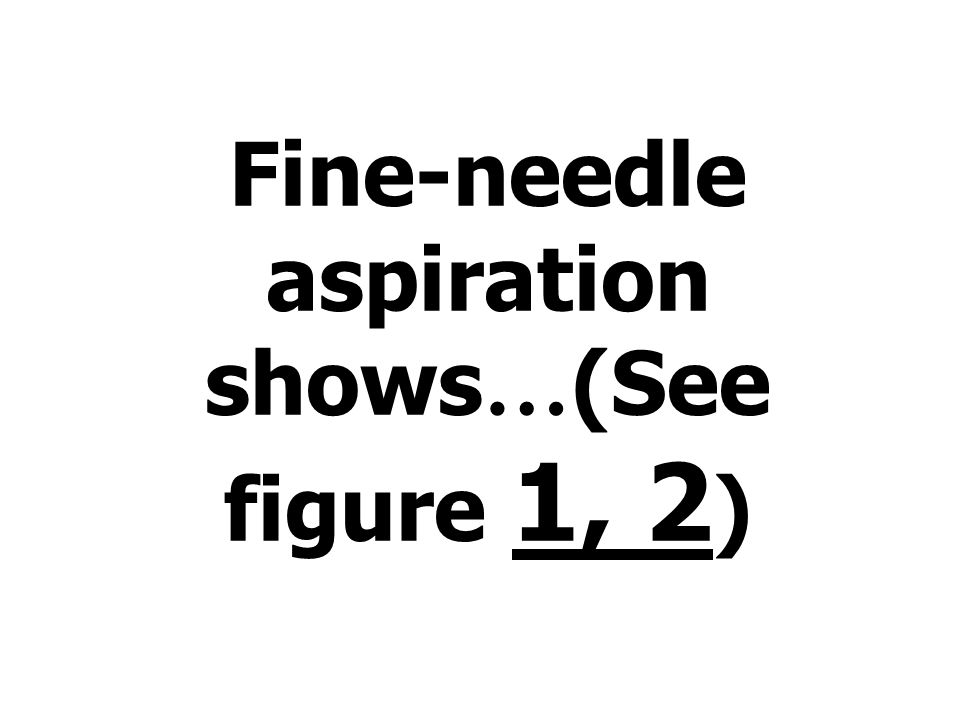Fine-needle aspiration shows … (See figure 1, 2 )